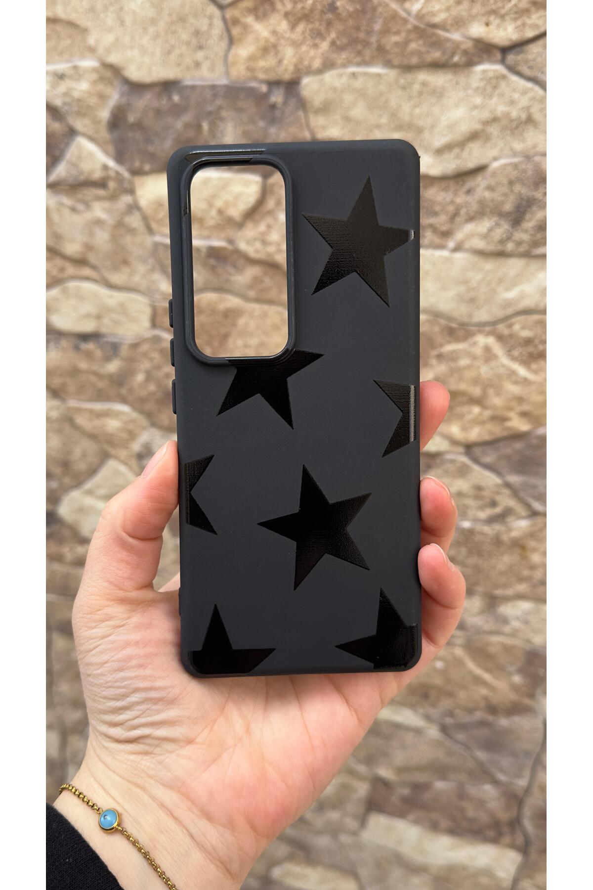 Vivo V30 Uyumlu Star Silikon Darbe Emici Klasik Korumalı Rubber Kılıf