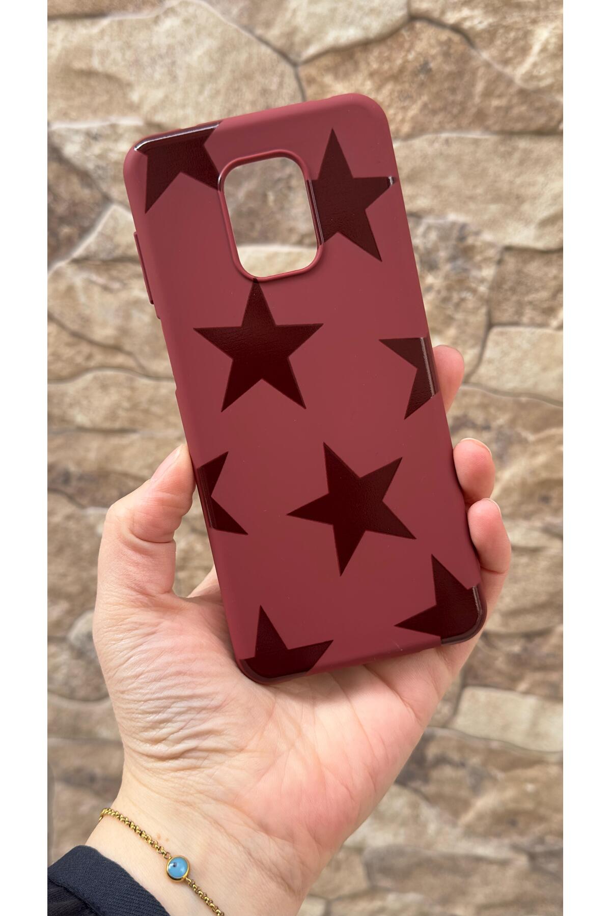 Redmi Note 9 Pro ve 9S Uyumlu Star Silikon Darbe Emici Klasik Korumalı Rubber Kılıf