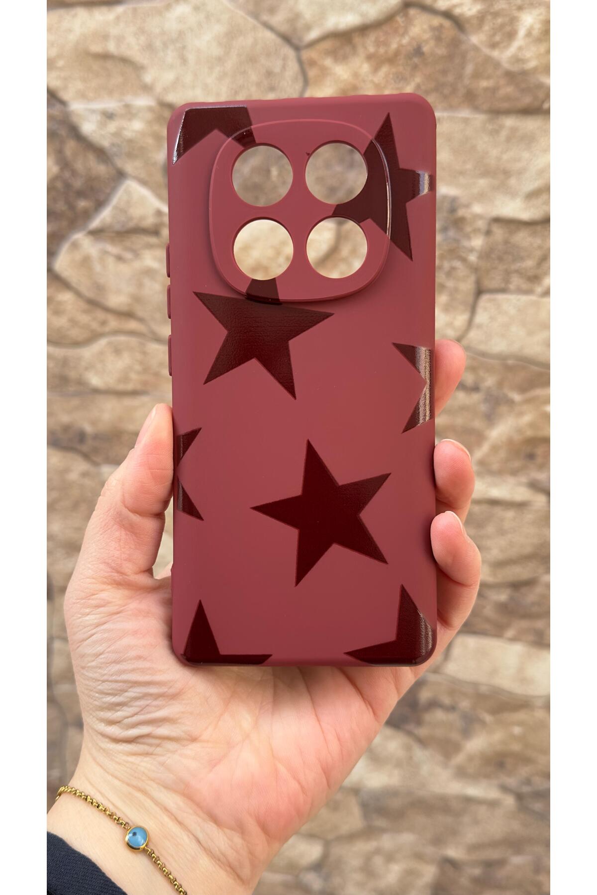 Redmi Note 14 Pro 4G Uyumlu Star Silikon Darbe Emici Klasik Korumalı Rubber Kılıf