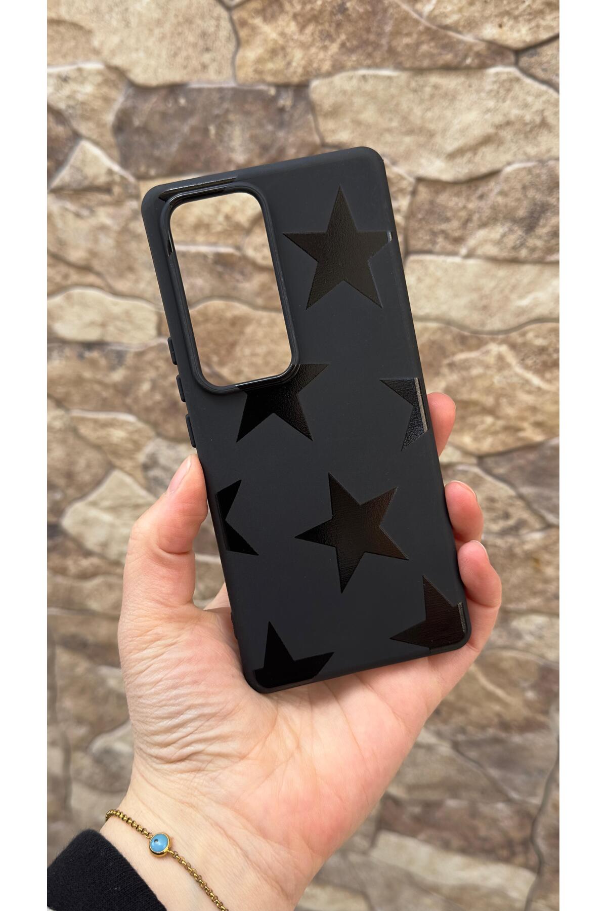 Vivo V30 Uyumlu Star Silikon Darbe Emici Klasik Korumalı Rubber Kılıf