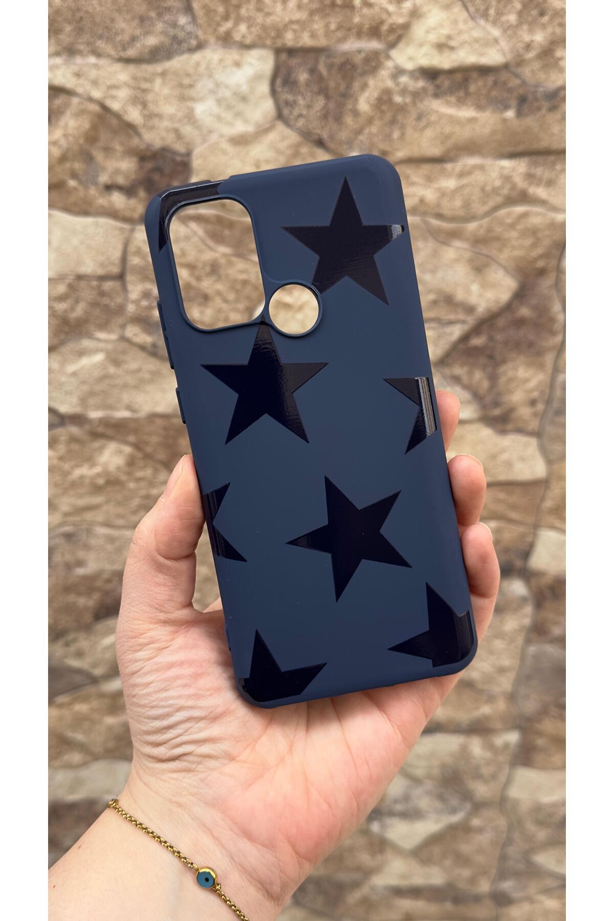 Casper Via F20 Uyumlu Star Silikon Darbe Emici Klasik Korumalı Rubber Kılıf