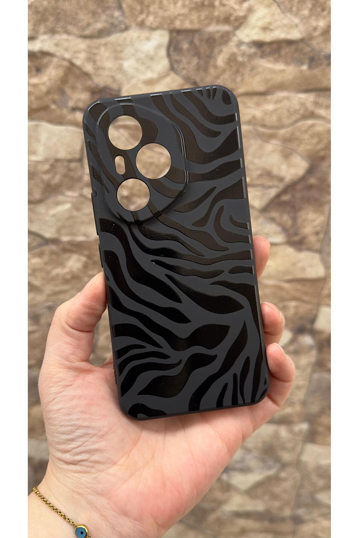Honor 400 Pro Uyumlu Zebra Desenli Silikon Darbe Emici Klasik Korumalı Rubber Kılıf