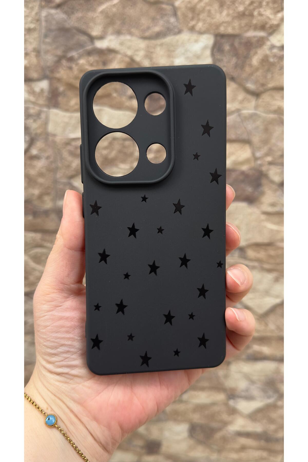 Redmi Note 13 Pro 4G Uyumlu Mini Siyah Yıldız Desenli Silikon Darbe Emici Klasik Korumalı Rubber Kılıf