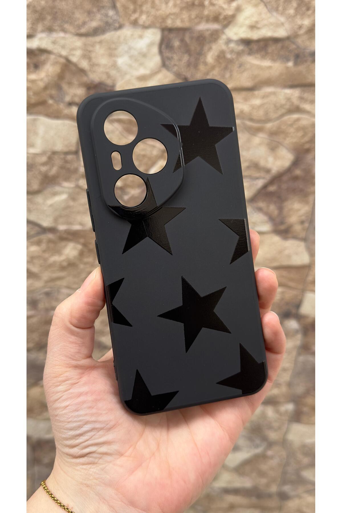 Honor 400 Pro Uyumlu Star Silikon Darbe Emici Klasik Korumalı Rubber Kılıf