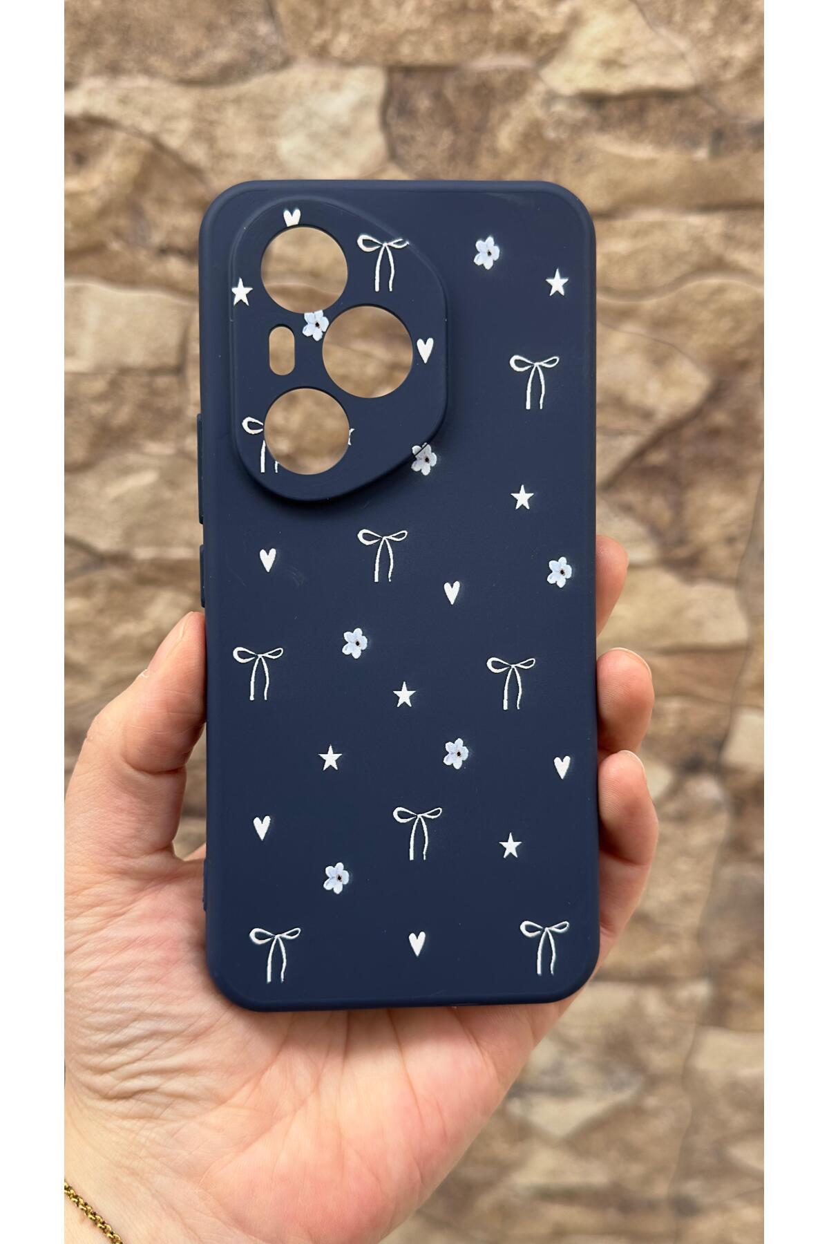 Honor 400 Pro Uyumlu Mini Fiyonk Desenli Silikon Darbe Emici Klasik Korumalı Rubber Kılıf