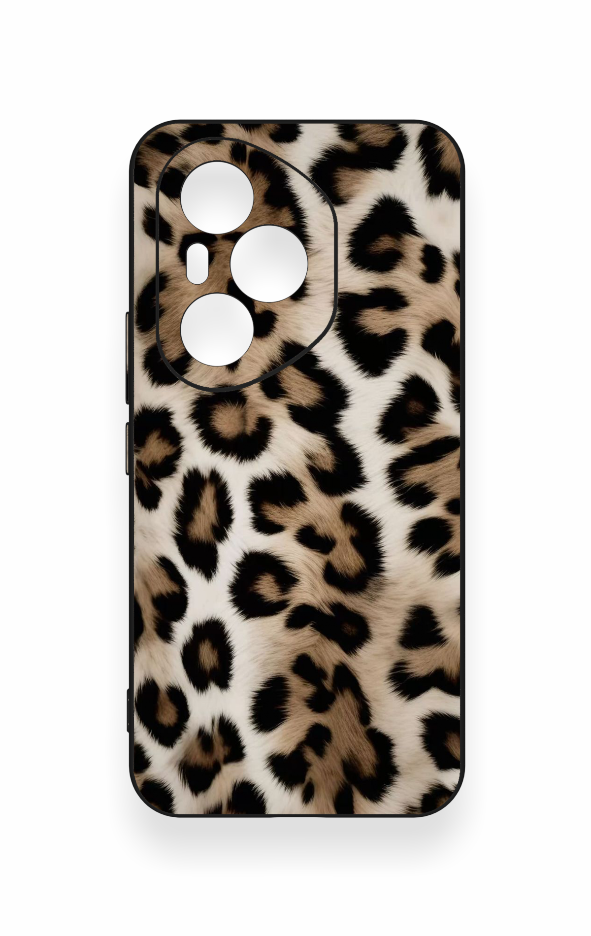 Honor 400 Pro Uyumlu Leopar Derisi Desenli Silikon Kılıf