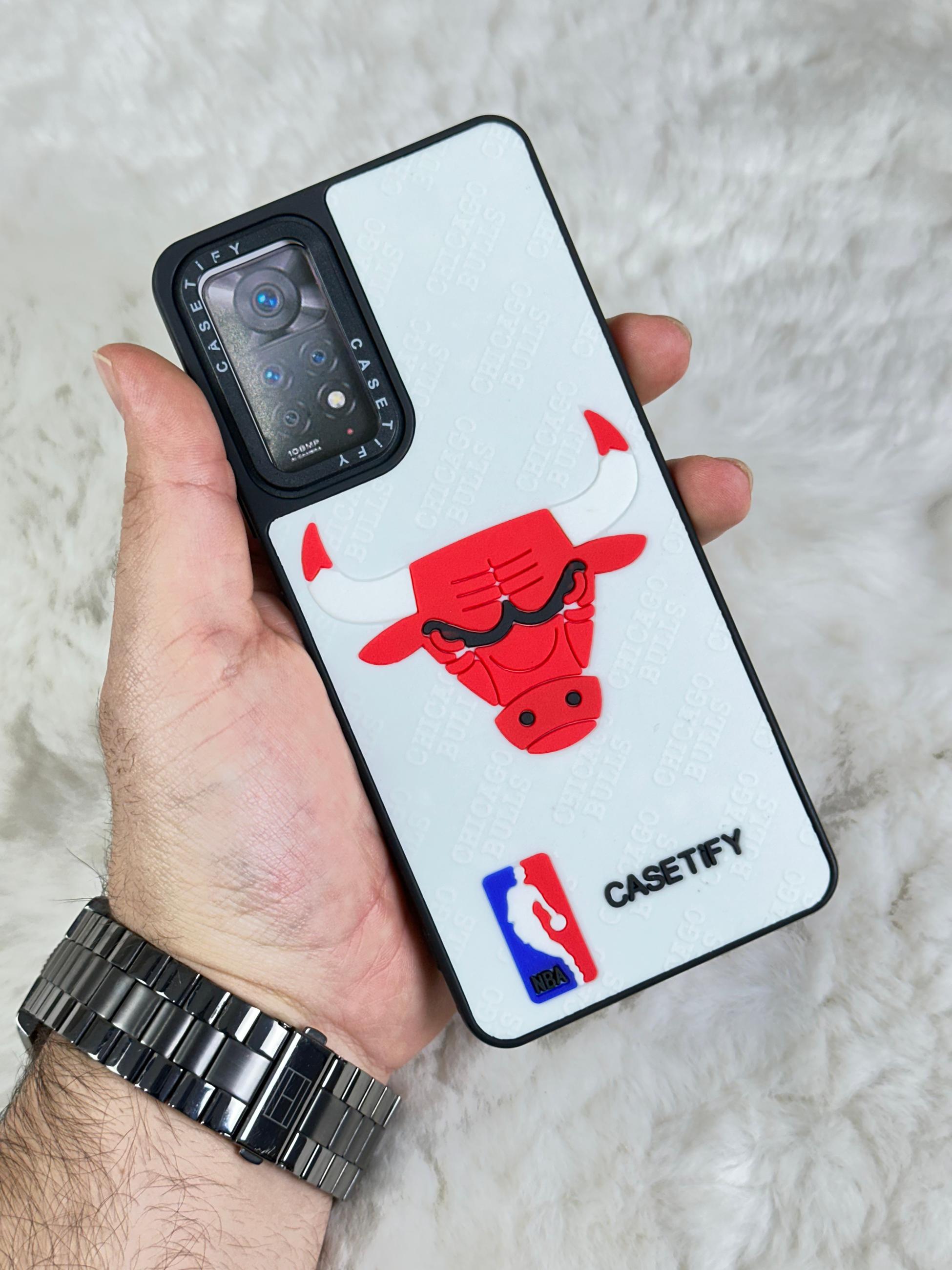 Xiaomi Redmi Note 11 Pro Stylish Kabartmalı Kılıf