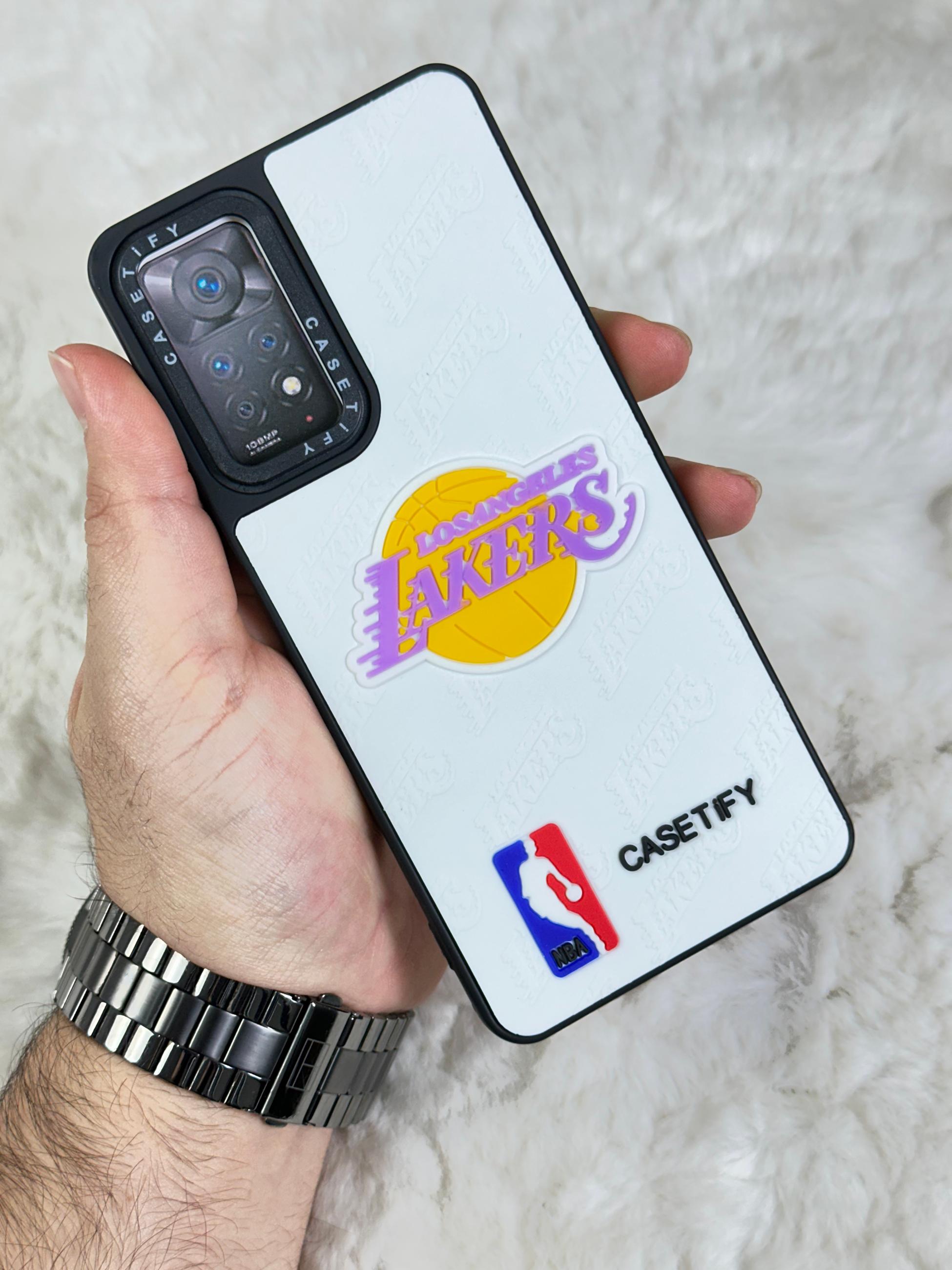 Xiaomi Redmi Note 11 Pro Stylish Kabartmalı Kılıf