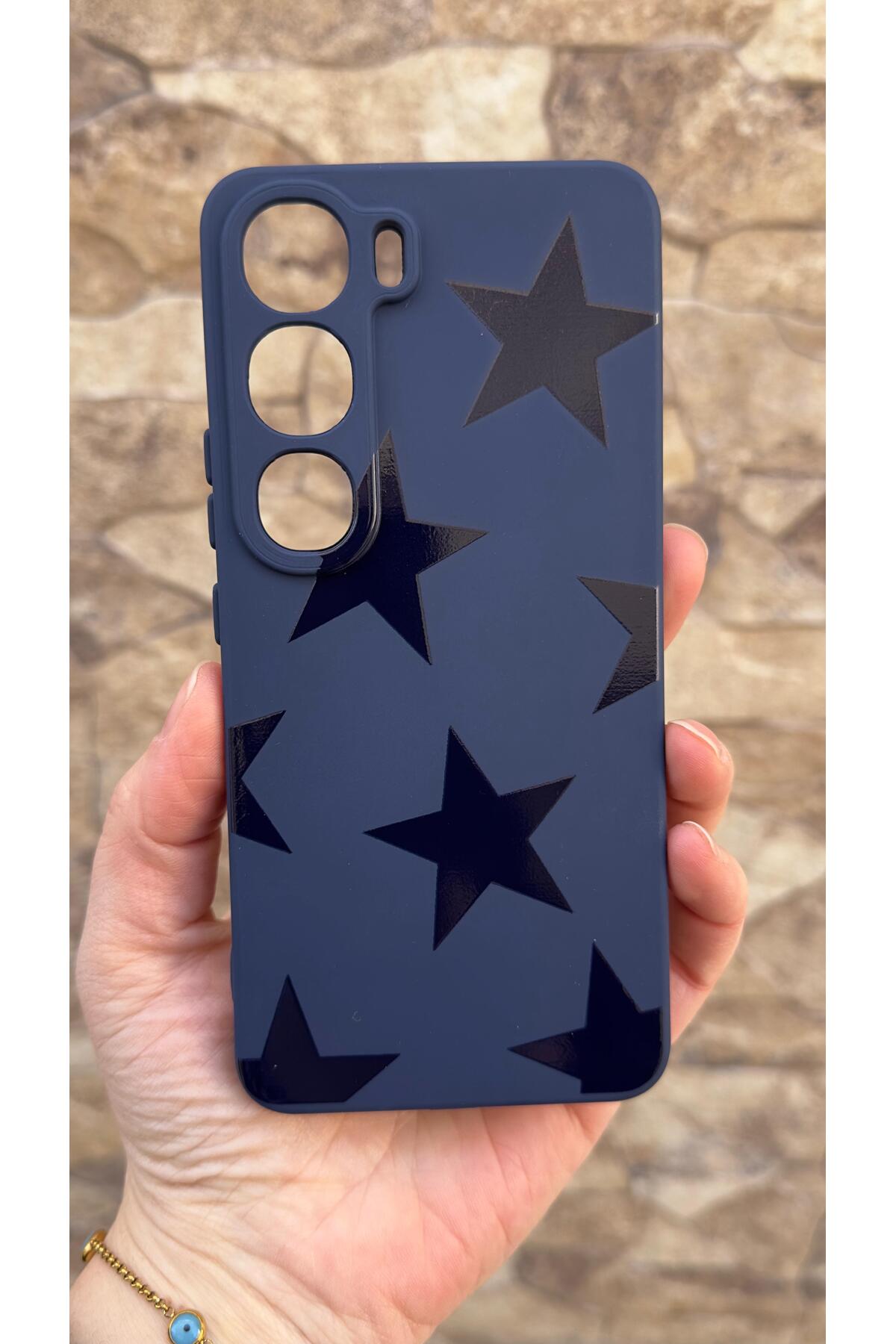 Vivo V40 Lite 5G Uyumlu Star Silikon Darbe Emici Klasik Korumalı Rubber Kılıf