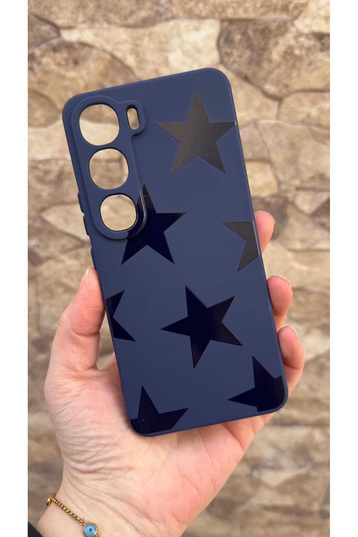 Vivo V40 Lite 5G Uyumlu Star Silikon Darbe Emici Klasik Korumalı Rubber Kılıf