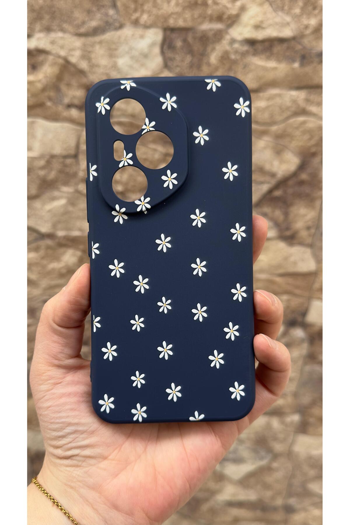 Honor 400 Pro Uyumlu Mini Papatya Desenli Silikon Darbe Emici Klasik Korumalı Rubber Kılıf