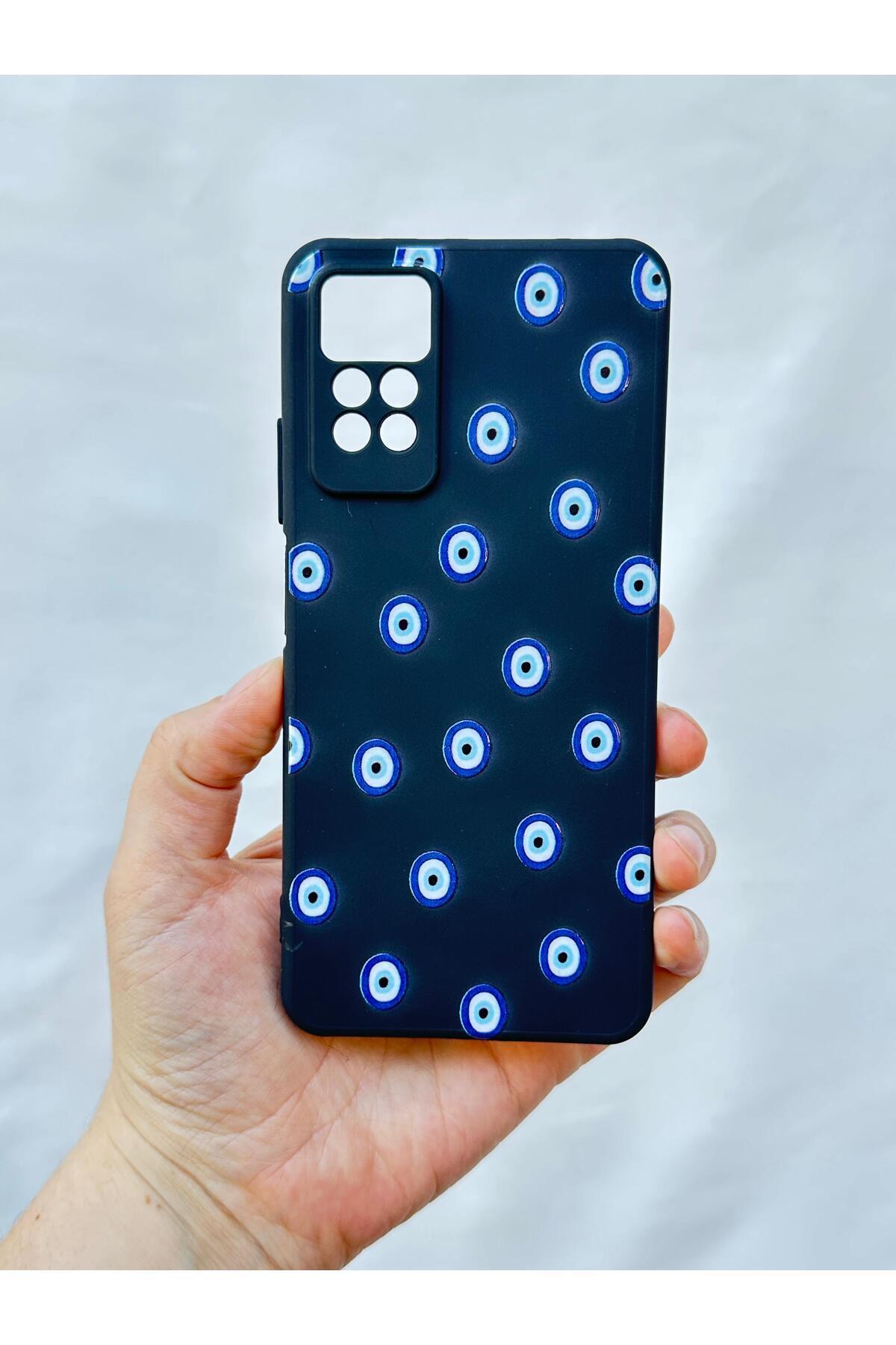 Redmi Note 11Pro/Note 12Pro4G NAZAR BONCUK DESENLİ Darbe Emici Klasik Korumalı Rubber Kılıf