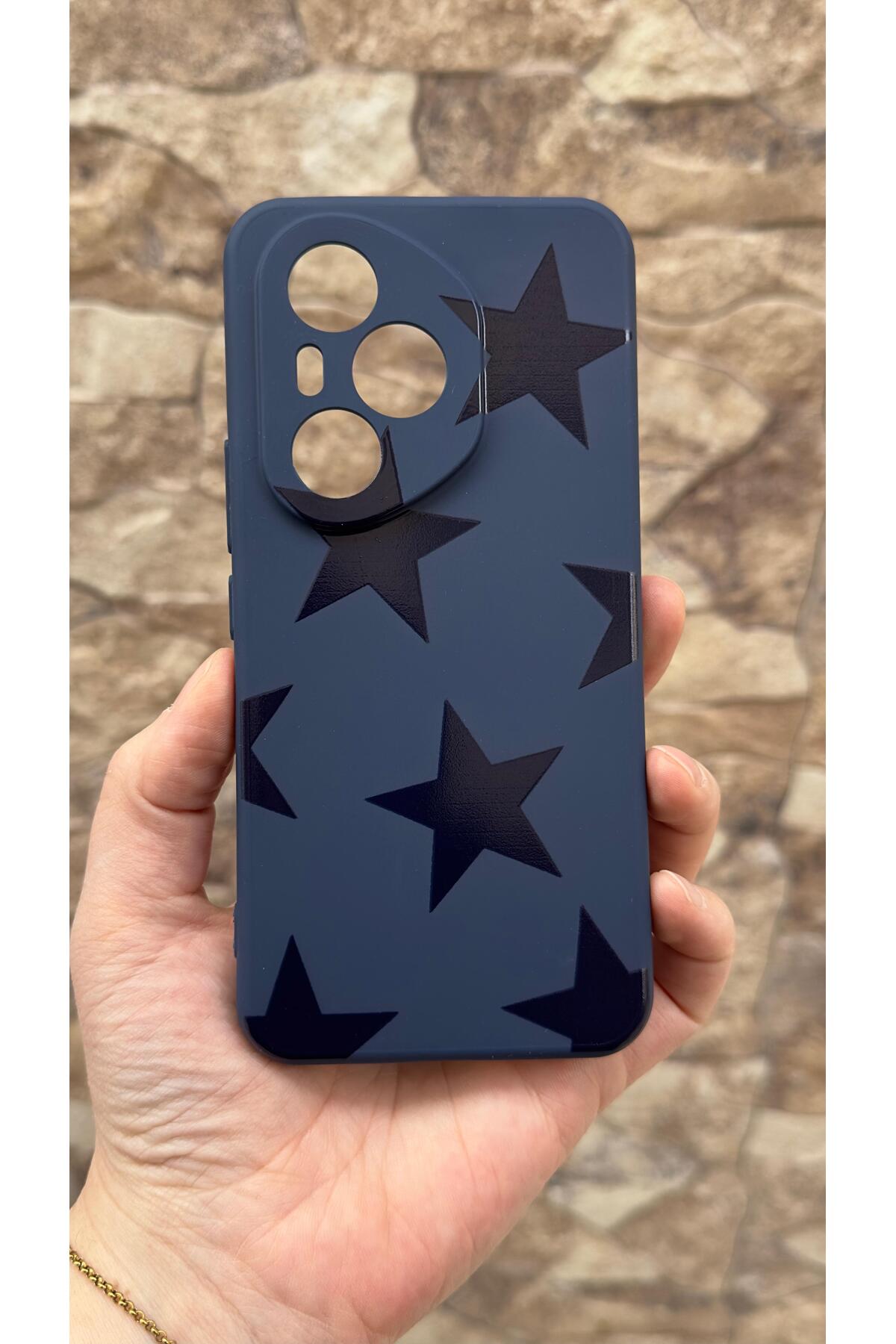 Honor 400 Pro Uyumlu Star Silikon Darbe Emici Klasik Korumalı Rubber Kılıf