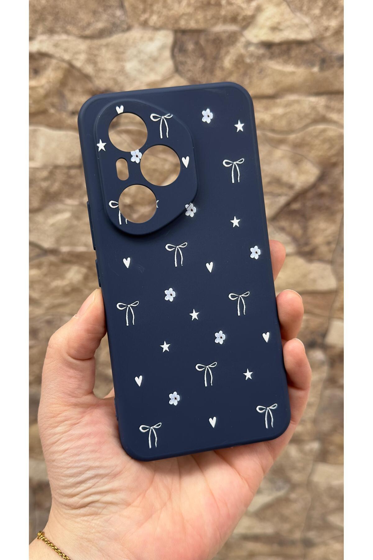 Honor 400 Pro Uyumlu Mini Fiyonk Desenli Silikon Darbe Emici Klasik Korumalı Rubber Kılıf