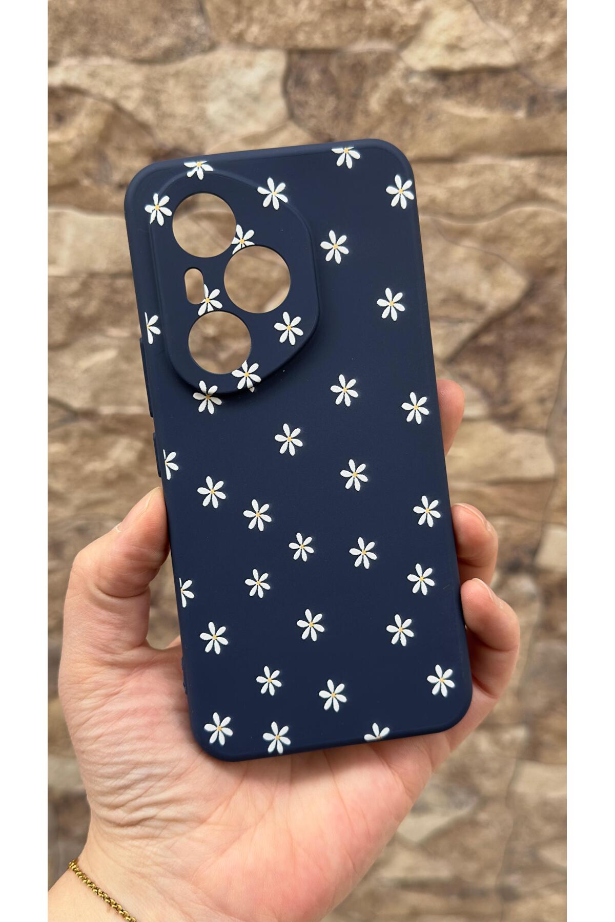 Honor 400 Pro Uyumlu Mini Papatya Desenli Silikon Darbe Emici Klasik Korumalı Rubber Kılıf