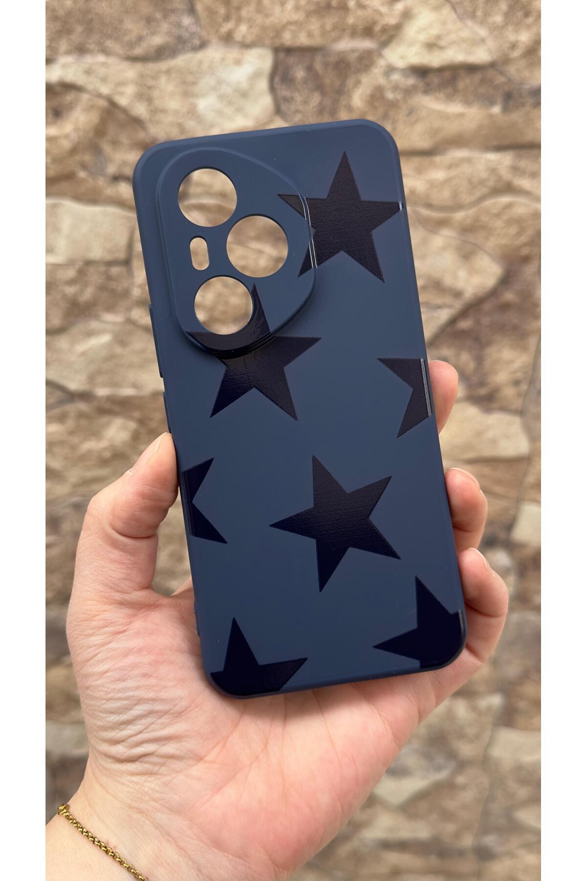 Honor 400 Pro Uyumlu Star Silikon Darbe Emici Klasik Korumalı Rubber Kılıf