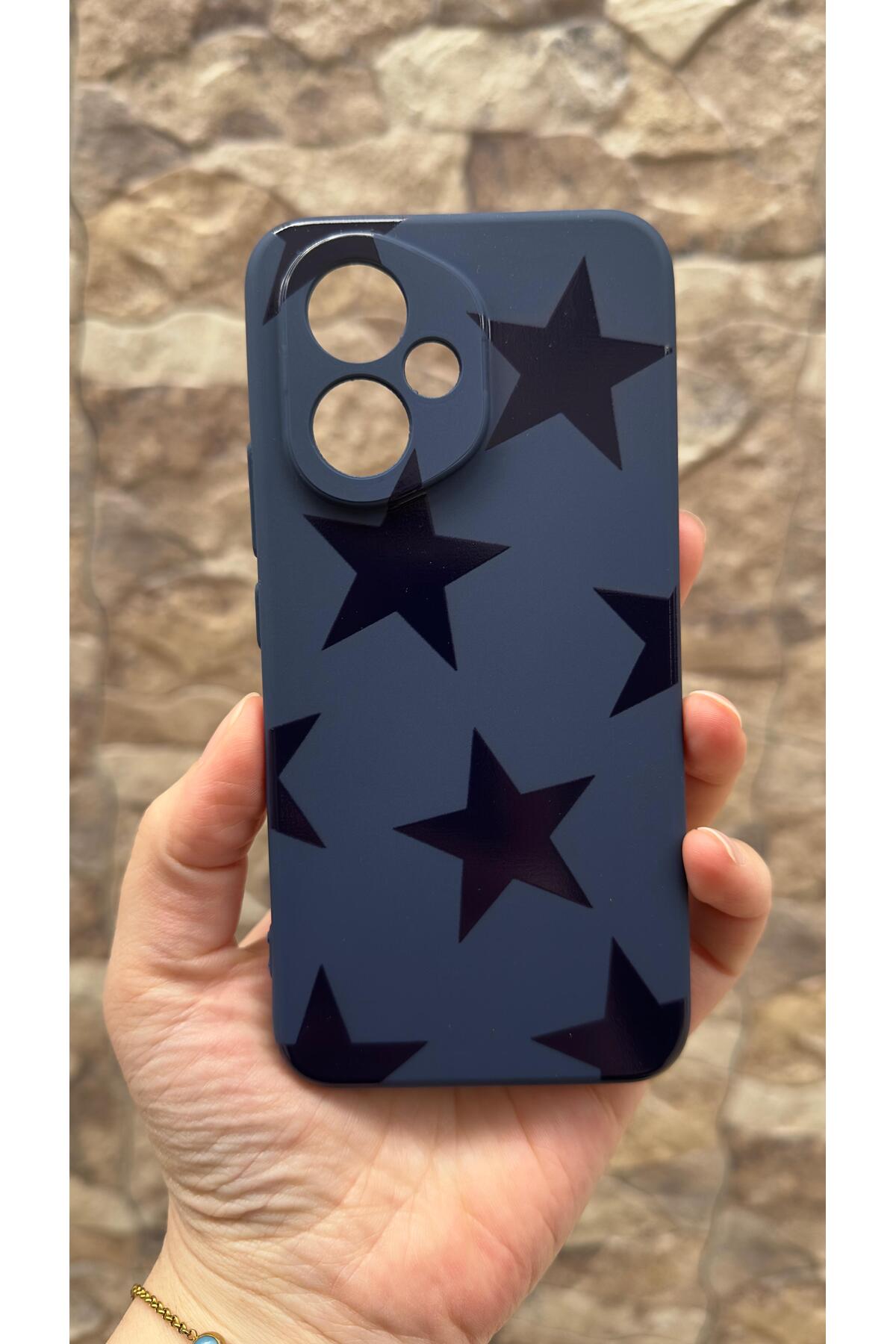 Honor 400 Uyumlu Star Silikon Darbe Emici Klasik Korumalı Rubber Kılıf