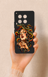 Tecno Camon 30 Uyumlu Medusa Desenli Silikon Kılıf